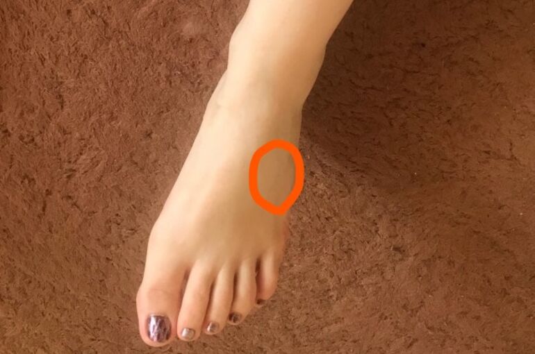 Inked4429229_s_LI 腓骨神経