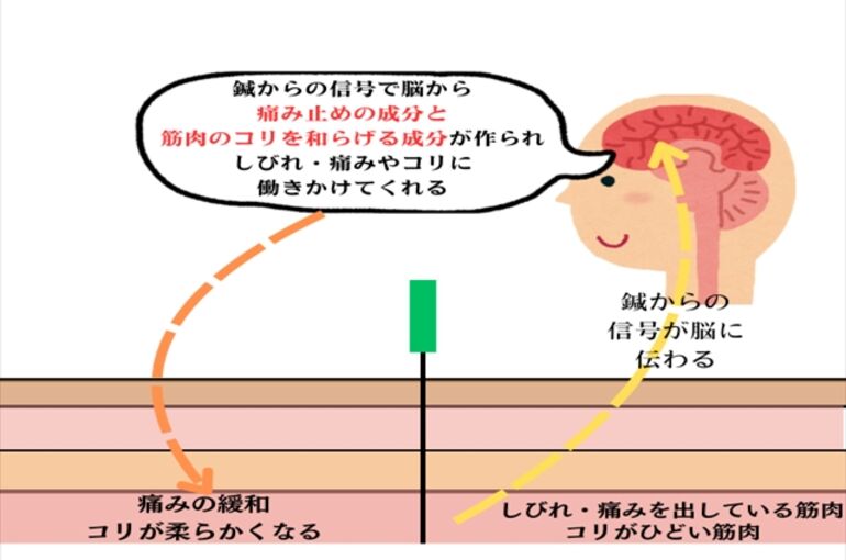 坐骨神経_R